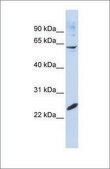 Anti-SMAD4 antibody produced in rabbit affinity isolated antibody