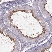 Anti-RSPH6A antibody produced in rabbit Prestige Antibodies® Powered by Atlas Antibodies, affinity isolated antibody, buffered aqueous glycerol solution