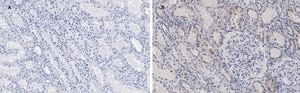 抗c-Myc抗体 クローン7E18 ZooMAb®ウサギモノクローナル recombinant, expressed in HEK 293 cells