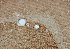 Anti-CNPase Antibody, clone 11-5B clone 11-5B, Chemicon®, from mouse