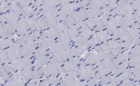 Anti-MYH1 Antibody, clone 1E15 , ZooMAb® Rabbit Monoclonal recombinant, expressed in HEK 293 cells