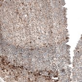 Anti-MB21D1 antibody produced in rabbit Prestige Antibodies® Powered by Atlas Antibodies, affinity isolated antibody, buffered aqueous glycerol solution