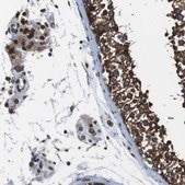Anti-TMX4 antibody produced in rabbit Prestige Antibodies® Powered by Atlas Antibodies, affinity isolated antibody, buffered aqueous glycerol solution