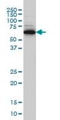 Monoclonal Anti-RAD18 antibody produced in mouse clone 3H7, purified immunoglobulin, buffered aqueous solution