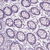 Anti-SPAG6 antibody produced in rabbit Prestige Antibodies® Powered by Atlas Antibodies, affinity isolated antibody, buffered aqueous glycerol solution