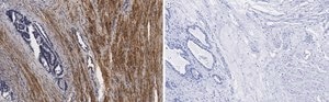 Anti-Vinculin Antibody, clone 3M13 ZooMAb® Rabbit Monoclonal recombinant, expressed in HEK 293 cells