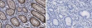 Anti-p-CREB (Ser133) Antibody, clone 1H13 ZooMAb® Rabbit Monoclonal recombinant, expressed in HEK 293 cells