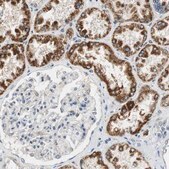 Anti-ALDH4A1 antibody produced in rabbit Prestige Antibodies® Powered by Atlas Antibodies, affinity isolated antibody, buffered aqueous glycerol solution