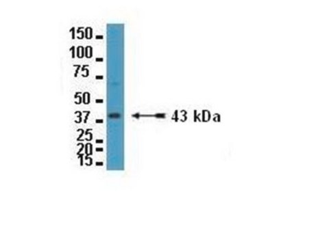 Anti-Connexin 43 Antibody Chemicon®, from rabbit