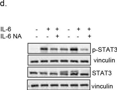 Anti-Vinculin Antibody, clone V284 clone V284, Upstate®, from mouse