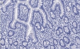 Anti-ATM Antibody, clone 4N19, ZooMAb® Rabbit Monoclonal recombinant, expressed in HEK 293 cells
