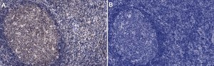 Anti-Caspase 3 Antibody Upstate®, from rabbit