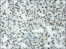 Anti-acetyl-Histone H3 (Ac-Lys9) antibody produced in rabbit 2-2.5 mg/mL, affinity isolated antibody, buffered aqueous solution