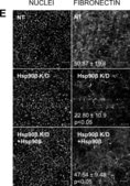 モノクロナール抗フィブロネクチン マウス宿主抗体 clone IST-4, purified from hybridoma cell culture