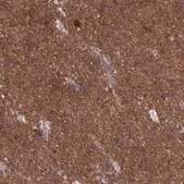 Anti-DNM1L antibody produced in rabbit Prestige Antibodies® Powered by Atlas Antibodies, affinity isolated antibody, buffered aqueous glycerol solution