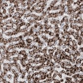 抗ABCD3抗体 ウサギ宿主抗体 Prestige Antibodies® Powered by Atlas Antibodies, affinity isolated antibody, buffered aqueous glycerol solution