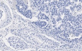 Anti-Nanog Antibody, clone 4C17 ZooMAb® Rabbit Monoclonal recombinant, expressed in HEK 293 cells