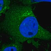 Anti-CHPF antibody produced in rabbit Prestige Antibodies® Powered by Atlas Antibodies, affinity isolated antibody, buffered aqueous glycerol solution