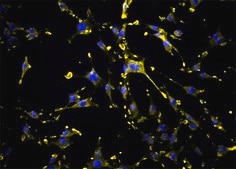 OSUMMER.6 Mouse NRAS-Mutant Melanoma Cell Line