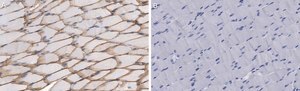 Anti-Dystrophin Antibody, clone 1G7, ZooMAb® Rabbit Monoclonal recombinant, expressed in HEK 293 cells