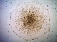 Stem Cell Qualified ECM Gel Stem cell qualified basement membrane extract (BME) for human ES and iPS cell culture.