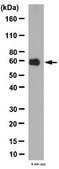 Anti-Cholesterol acyltransferase 1 Antibody from rabbit, purified by affinity chromatography