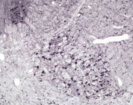 Anti-Nitric Oxide Synthase I Antibody Chemicon®, from rabbit