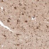 Anti-PREX1 antibody produced in rabbit Prestige Antibodies® Powered by Atlas Antibodies, affinity isolated antibody, buffered aqueous glycerol solution