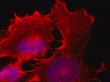 Anti-E6AP antibody, Mouse monoclonal clone E6AP-330, purified from hybridoma cell culture
