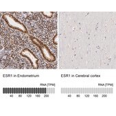 抗ESR1 ウサギ宿主抗体 Ab2, Prestige Antibodies® Powered by Atlas Antibodies, affinity isolated antibody, buffered aqueous glycerol solution
