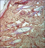 モノクロナール抗コラーゲン, III型 マウス宿主抗体 clone FH-7A, ascites fluid