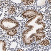 抗PGR ウサギ宿主抗体 Ab1, Prestige Antibodies® Powered by Atlas Antibodies, affinity isolated antibody, buffered aqueous glycerol solution