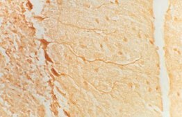 Anti-Glutamate Decarboxylase 65 &amp; 67 Antibody Chemicon®, from rabbit