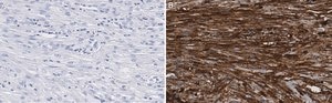 Anti-β-Actin Antibody, clone 6L12, ZooMAb® Rabbit Monoclonal recombinant, expressed in HEK 293 cells