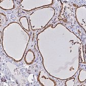 Anti-SYNCRIP antibody produced in rabbit Prestige Antibodies® Powered by Atlas Antibodies, affinity isolated antibody, buffered aqueous glycerol solution