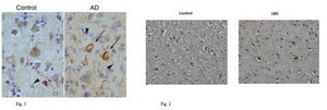 Anti-Tau (T22), oligomeric Antibody serum, from rabbit
