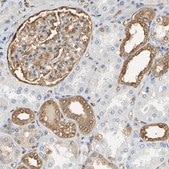 Anti-S100A6 antibody produced in rabbit Prestige Antibodies® Powered by Atlas Antibodies, affinity isolated antibody, buffered aqueous glycerol solution