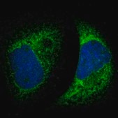 Anti-MTDH antibody produced in rabbit Ab1, Prestige Antibodies® Powered by Atlas Antibodies, affinity isolated antibody, buffered aqueous glycerol solution