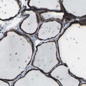 Anti-CMTM4 antibody produced in rabbit Prestige Antibodies® Powered by Atlas Antibodies, affinity isolated antibody, buffered aqueous glycerol solution