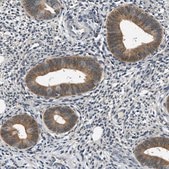 Anti-SMAD4 antibody produced in rabbit Prestige Antibodies® Powered by Atlas Antibodies, affinity isolated antibody, buffered aqueous glycerol solution
