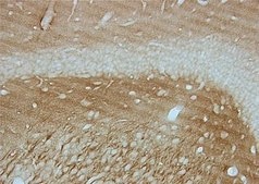 Anti-Tau-1 Antibody, clone PC1C6 clone PC1C6, Chemicon®, from mouse