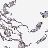 Anti-SLC16A3 antibody produced in rabbit Prestige Antibodies® Powered by Atlas Antibodies, affinity isolated antibody, buffered aqueous glycerol solution