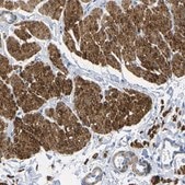 Anti-CNN1 antibody produced in rabbit Prestige Antibodies® Powered by Atlas Antibodies, affinity isolated antibody, buffered aqueous glycerol solution