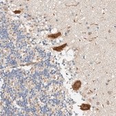 Anti-RAB11FIP1 antibody produced in rabbit Prestige Antibodies® Powered by Atlas Antibodies, affinity isolated antibody, buffered aqueous glycerol solution, Ab1