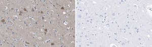 Anti-PSD-95 Antibody, clone 2B20 ZooMAb® Rabbit Monoclonal recombinant, expressed in HEK 293 cells
