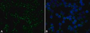 Anti-Chloramphenicol Acetyl Transferase (CAT) antibody produced in rabbit IgG fraction of antiserum, buffered aqueous solution