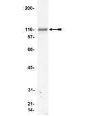 Anti-Vinculin Antibody, clone V284 clone V284, Upstate®, from mouse