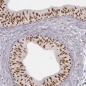 Anti-PHF6 antibody produced in rabbit affinity isolated antibody, buffered aqueous glycerol solution