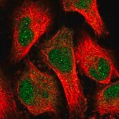 Anti-STN1 antibody produced in rabbit Prestige Antibodies® Powered by Atlas Antibodies, affinity isolated antibody, buffered aqueous glycerol solution