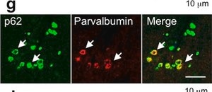 Anti-Parvalbumin Antibody ascites fluid, clone PARV-19, Chemicon®